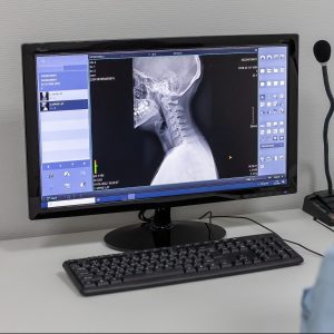 Maîtrisez Les Douleurs Irradiantes Du Cou En Comprenant Leur Origine Clinique Tagmed Montréal Terrebonne