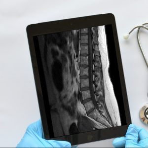 Les Troubles Musculosquelettiques (Tms) Clinique Tagmed Montréal Terrebonne