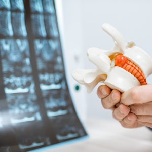 Douleurs Chroniques Clinique Tagmed Montréal Terrebonne Douleurs Chroniques Clinique Tagmed Montréal Terrebonne