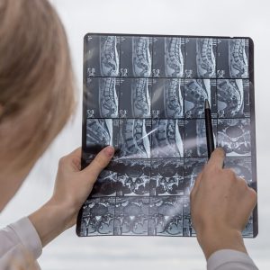 Traitement De La Hernie Discale À Rosemère Clinique Tagmed Montréal Terrebonne